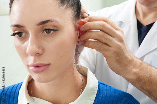Otoplasty
